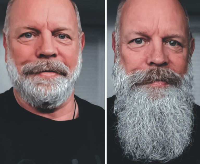 Do Beard Growth Kits Actually Work? A Comprehensive Review